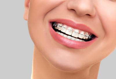 advanced technology braces in reno nv