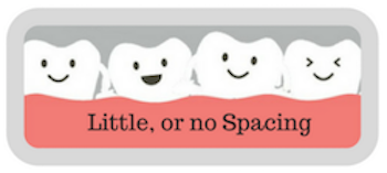 invisalign quiz