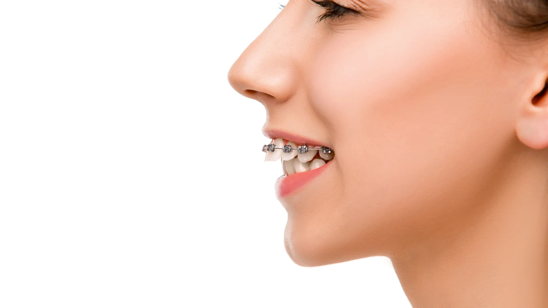 orthodontist near me