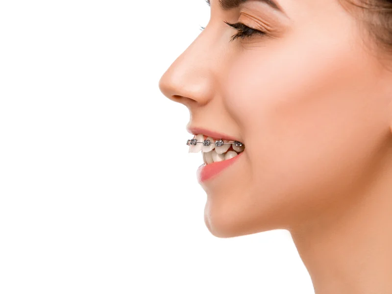 orthodontist near me