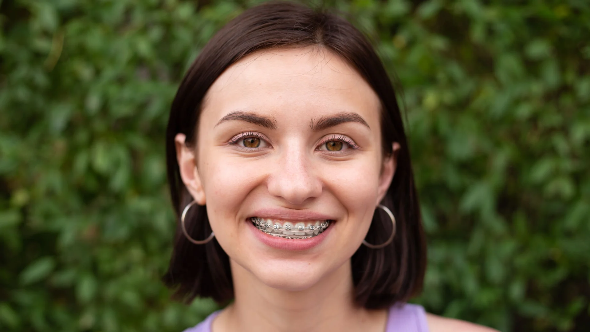 braces in Reno NV