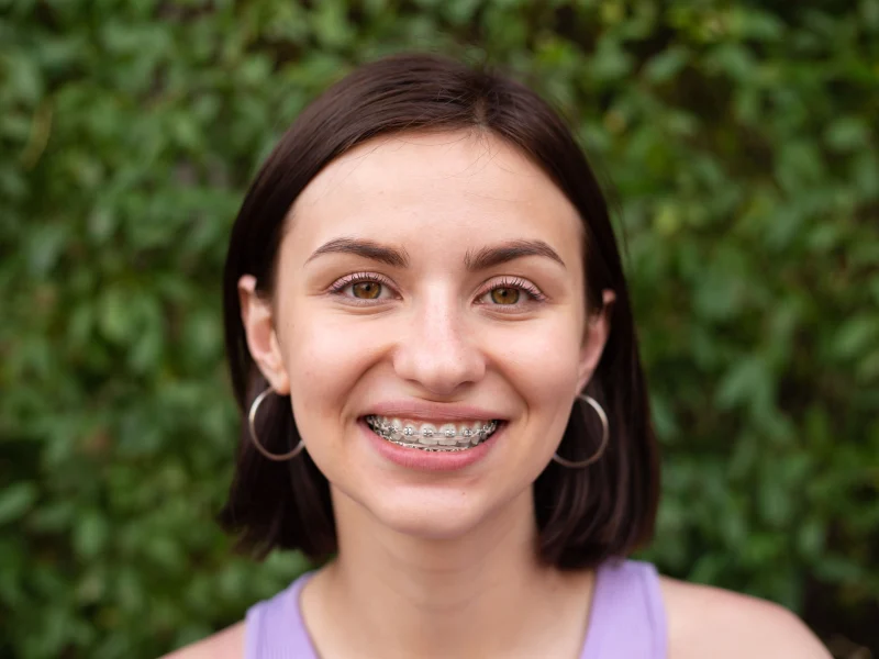 braces in Reno NV