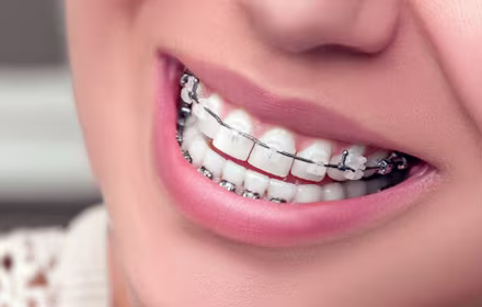 Advanced Technology Braces